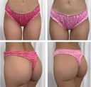 PACK X 2 COLALES FRUFRU ESTAMPADAS SAN VALENTIN